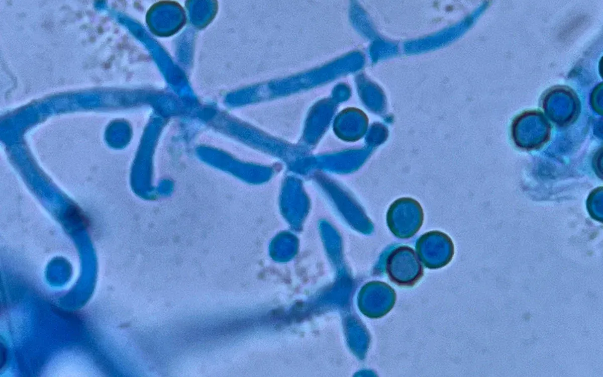 Rhizobactéries et champignons Trichoderma